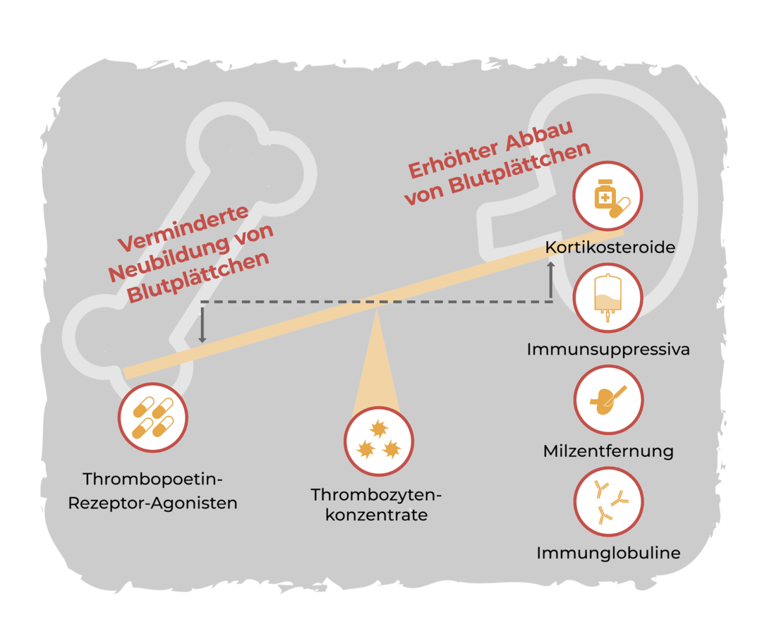 ITP: Therapie | Leben-mit-blutkrankheiten.de